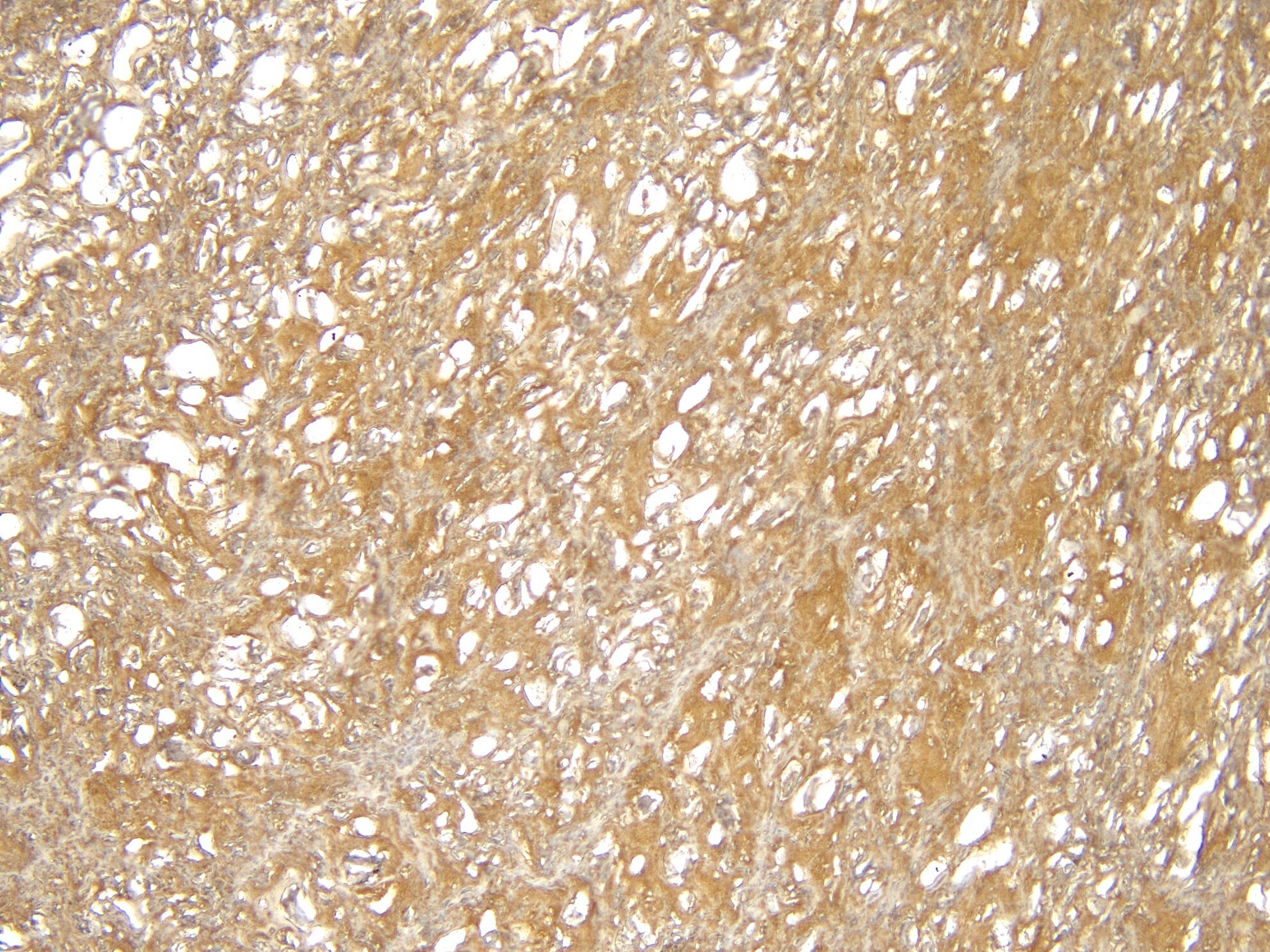 TRIM8 Antibody
