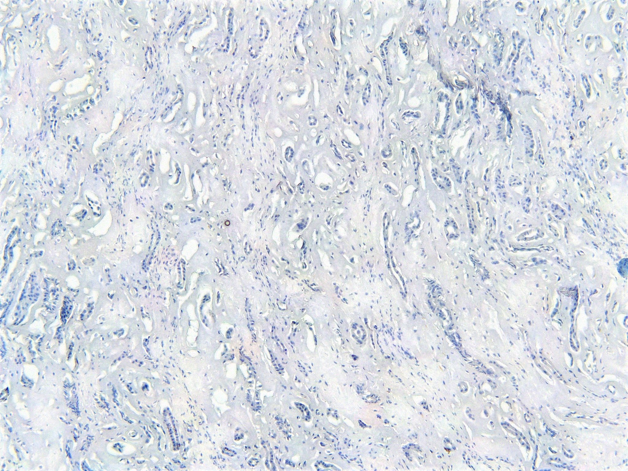 TRIM8 Antibody