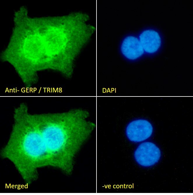 TRIM8 Antibody