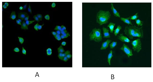 Park7/DJ-1 Antibody