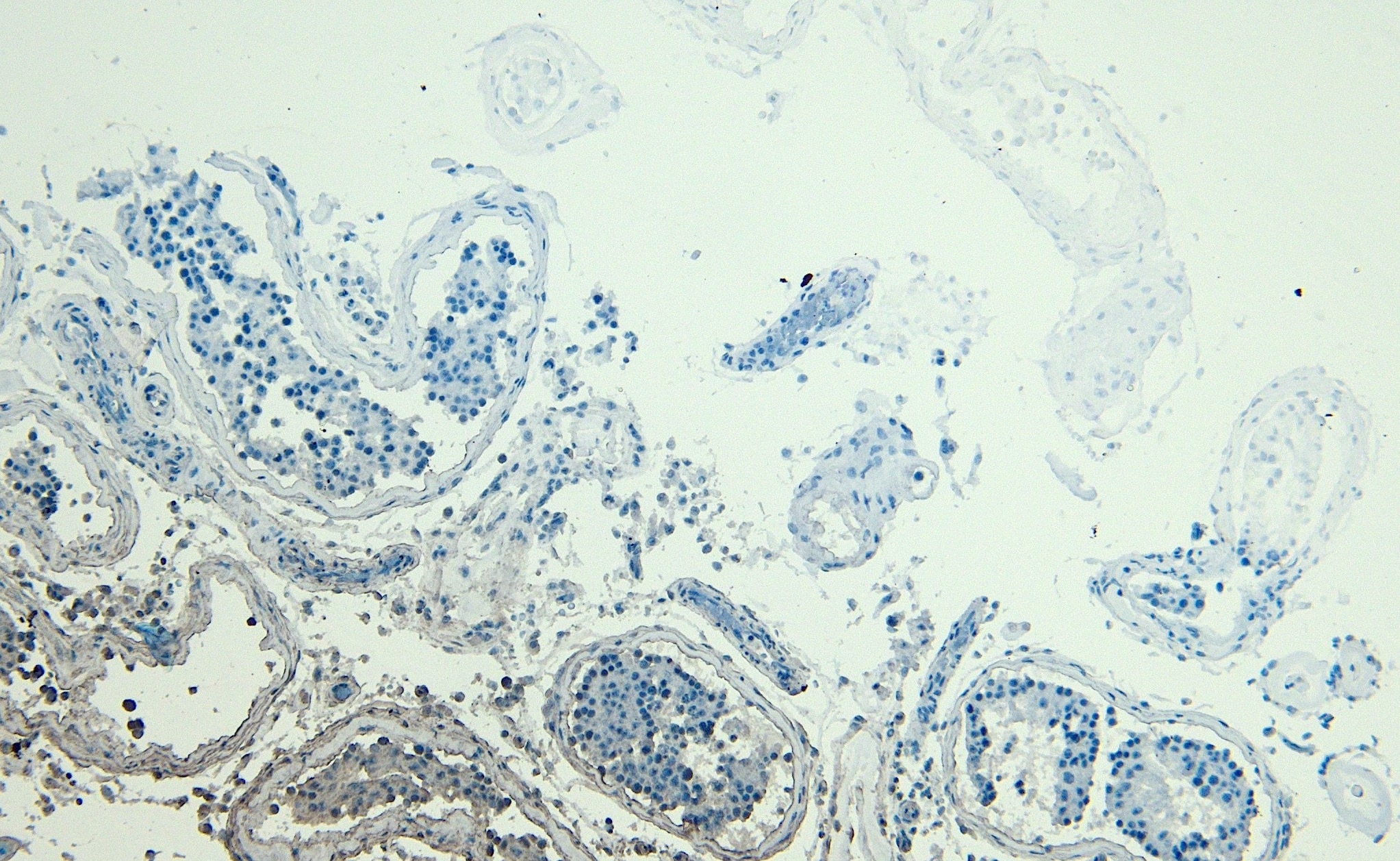 Park7/DJ-1 Antibody