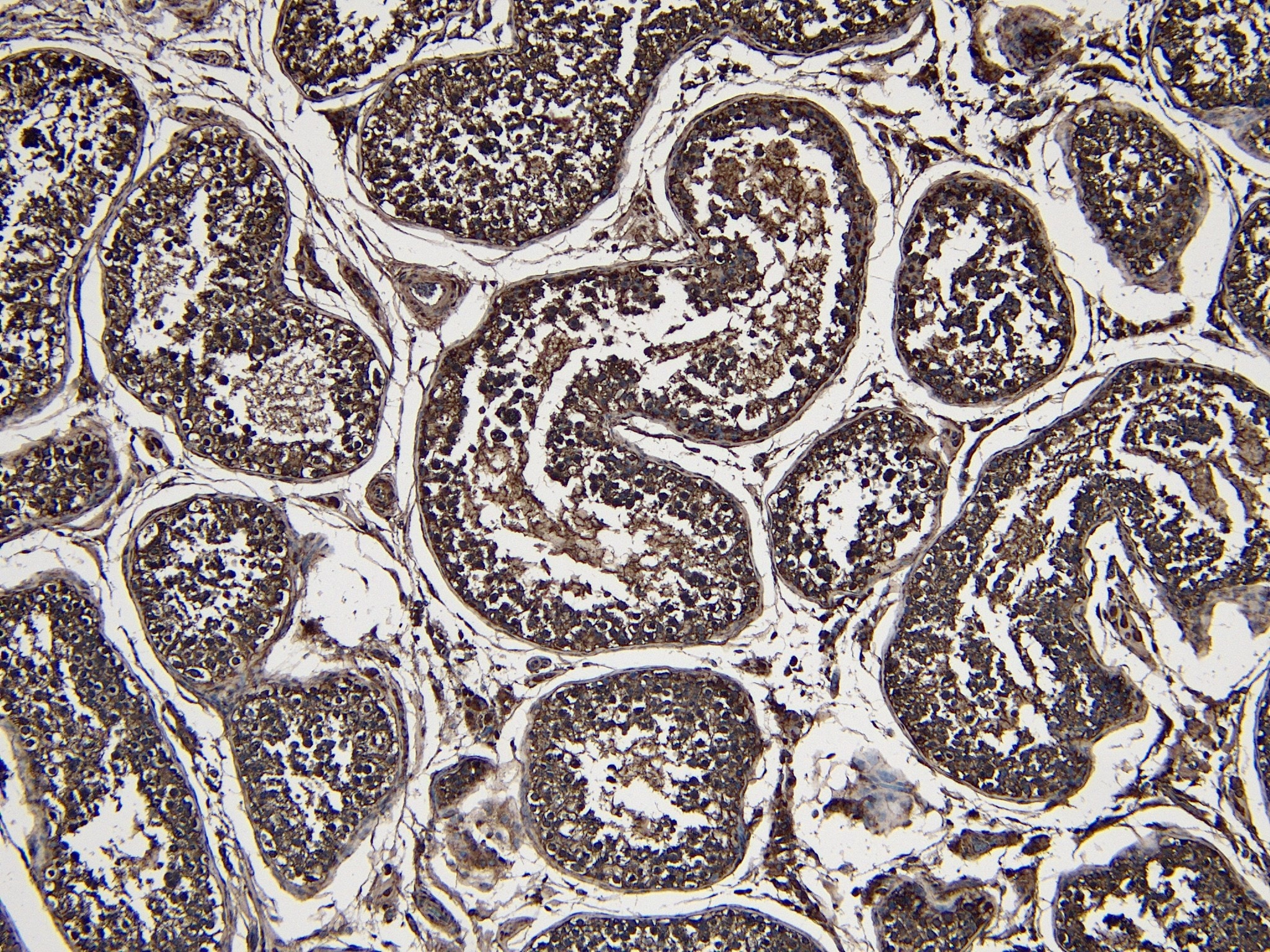 Park7/DJ-1 Antibody