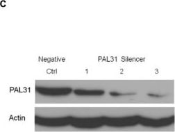 ANP32B Antibody