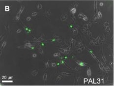 ANP32B Antibody