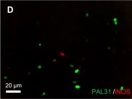 ANP32B Antibody
