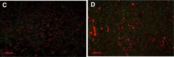 ANP32B Antibody
