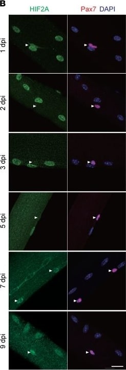 HIF-2 alpha/EPAS1 Antibody - BSA Free