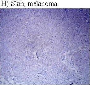 HIF-1 alpha Antibody (H1alpha67)