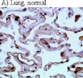 HIF-1 alpha Antibody (H1alpha67)