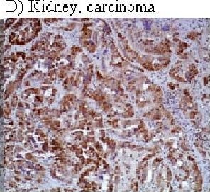 HIF-1 alpha Antibody (H1alpha67)