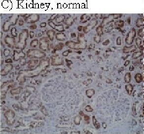 HIF-1 alpha Antibody (H1alpha67)