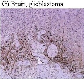HIF-1 alpha Antibody (H1alpha67)