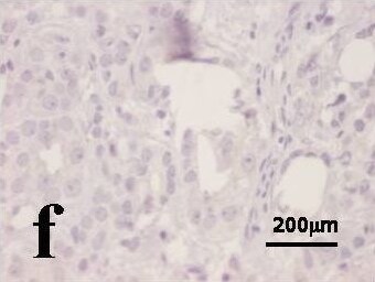 HIF-1 alpha Antibody (H1alpha67)