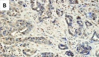 HIF-1 alpha Antibody (ESEE122)