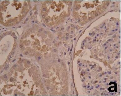 HIF-1 alpha Antibody (ESEE122)