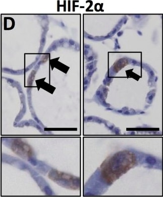 HIF-2 alpha/EPAS1 Antibody (ep190b)