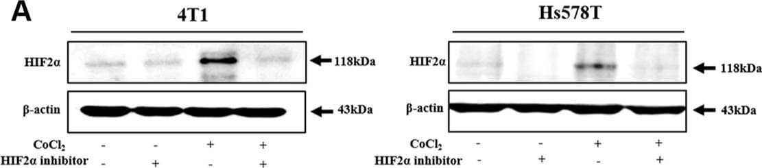 HIF-2 alpha/EPAS1 Antibody (ep190b)