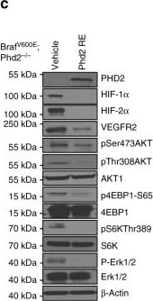 HIF-2 alpha/EPAS1 Antibody (ep190b)