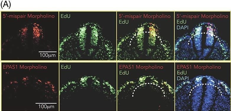 HIF-2 alpha/EPAS1 Antibody (ep190b)