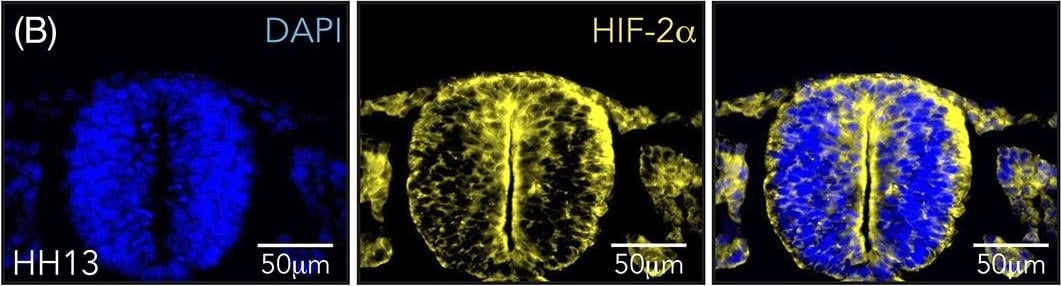 HIF-2 alpha/EPAS1 Antibody (ep190b)