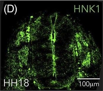 HIF-2 alpha/EPAS1 Antibody (ep190b)