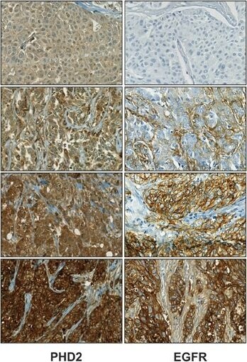 EGLN1/PHD2 Antibody