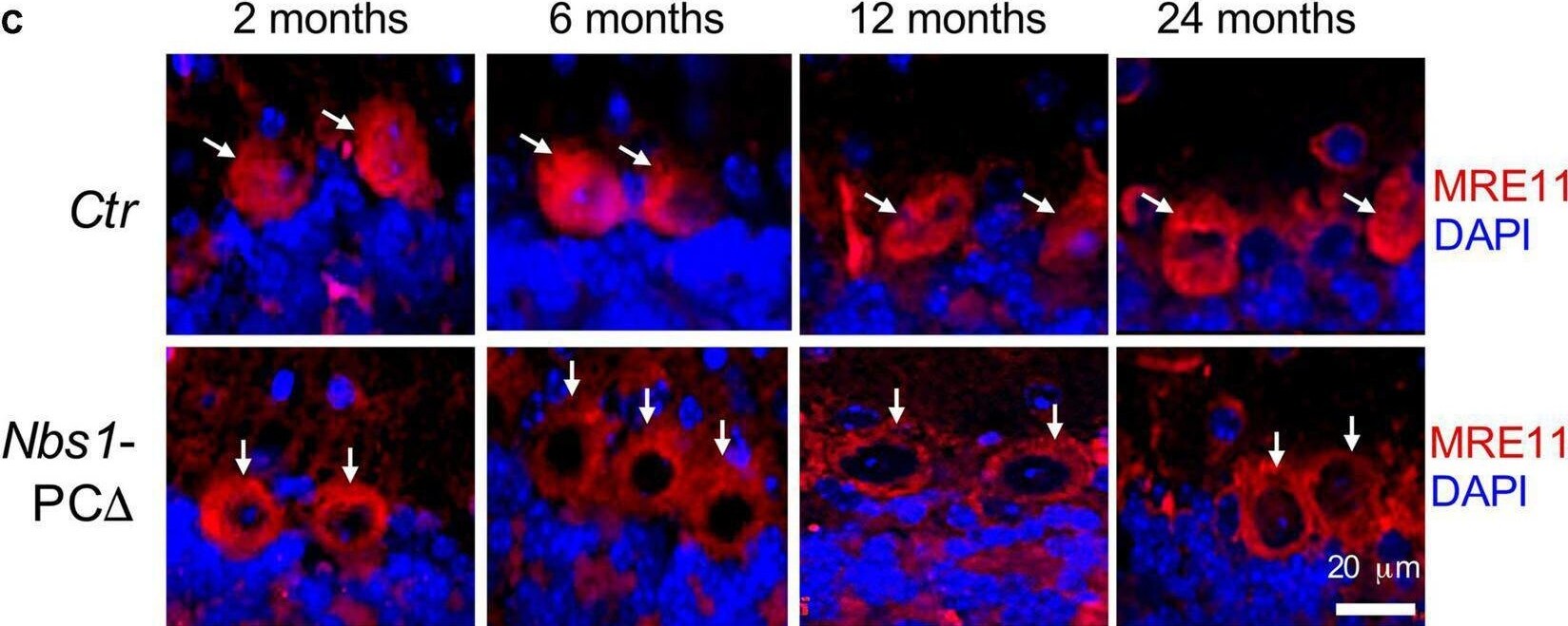 Mre11 Antibody - BSA Free