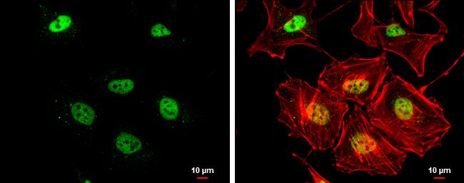 Rad50 Antibody (13B3) - Azide and BSA Free