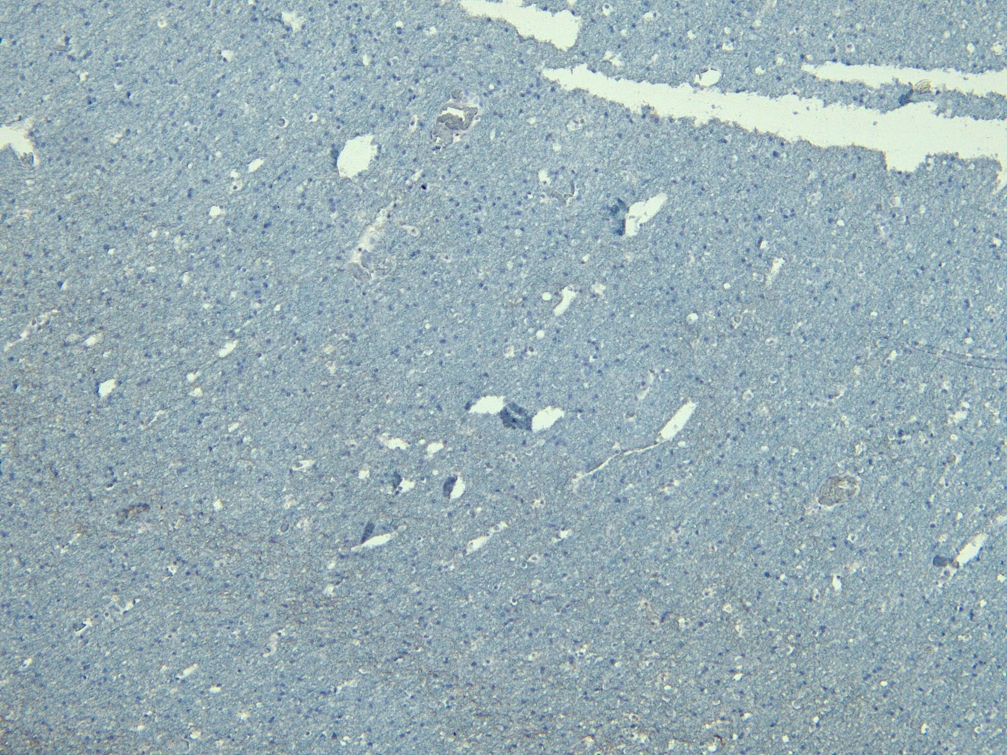 GAD2/GAD65 Antibody