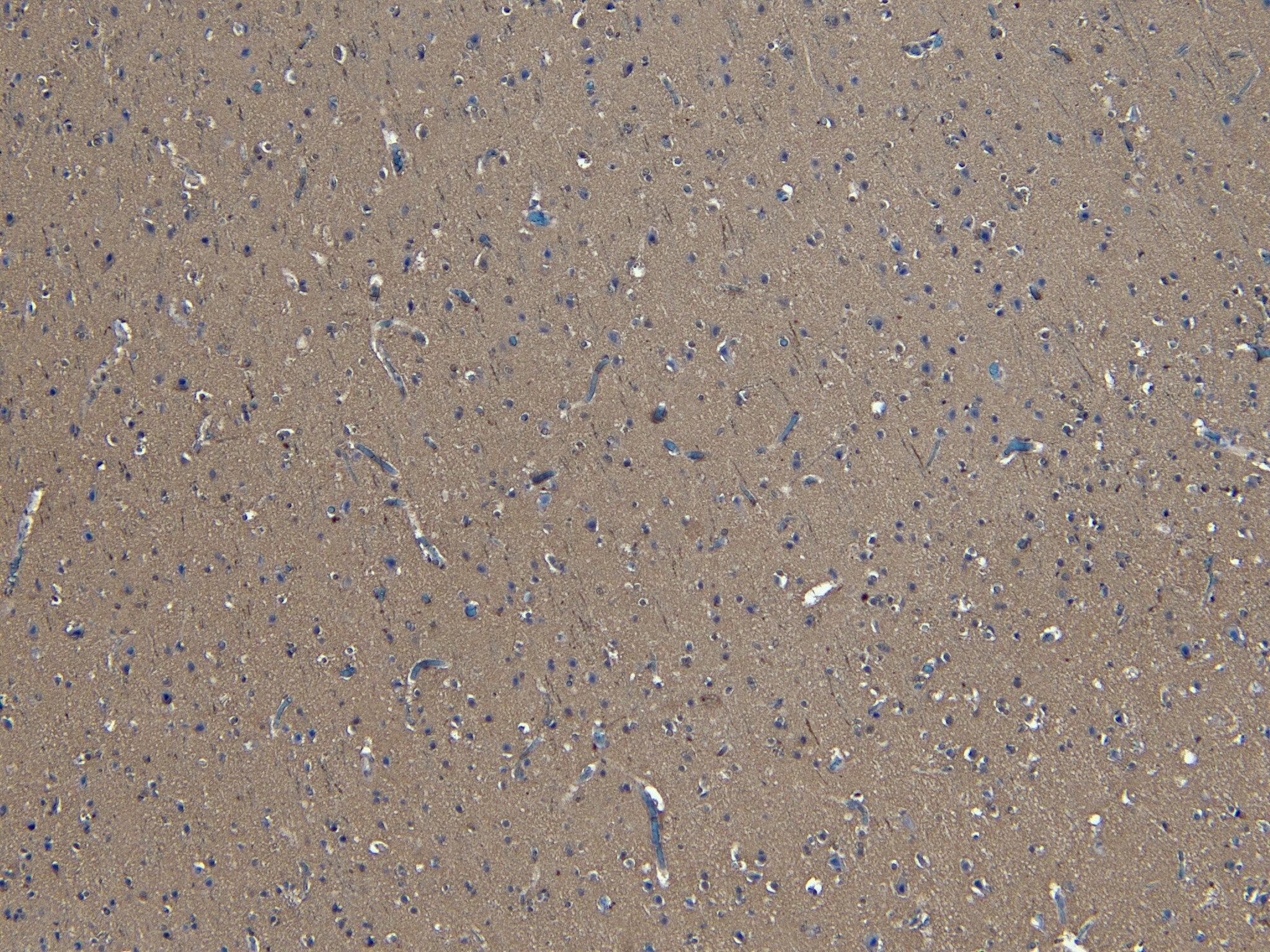 GAD2/GAD65 Antibody