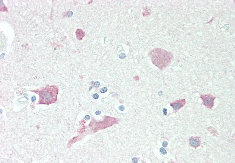 Serpin I1/Neuroserpin Antibody
