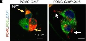 POMC Antibody