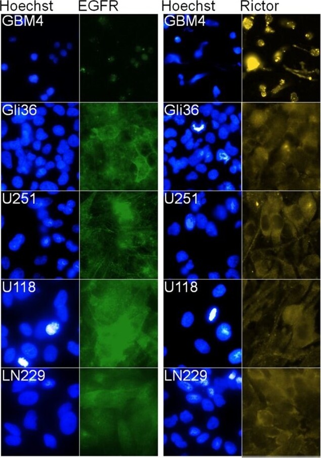 Rictor Antibody