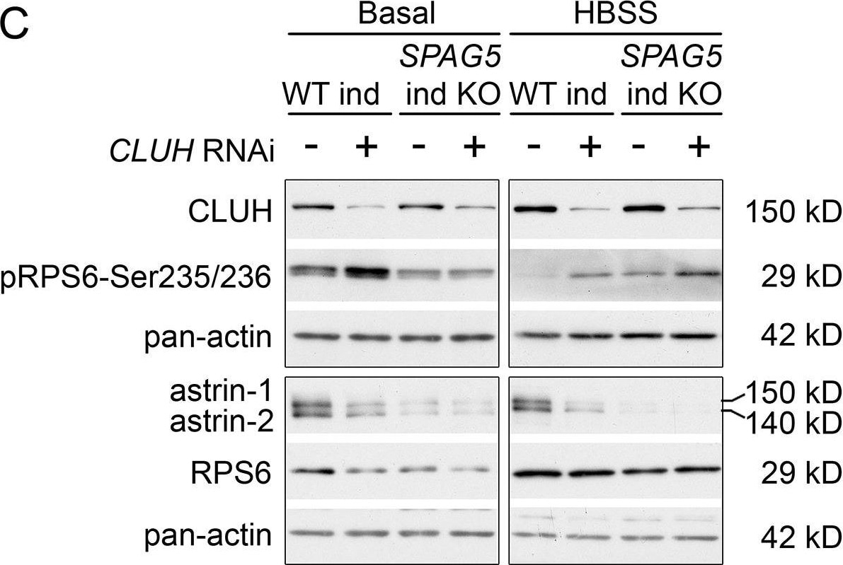 Ribosomal Protein S6/RPS6 Antibody