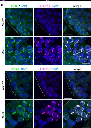 Ribosomal Protein S6/RPS6 Antibody
