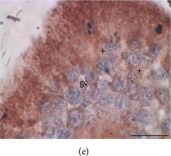 Aromatase Antibody