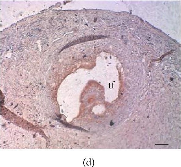 Aromatase Antibody