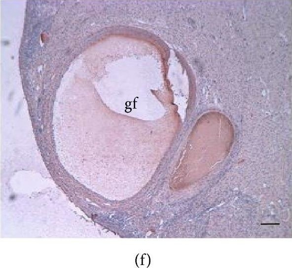 Aromatase Antibody