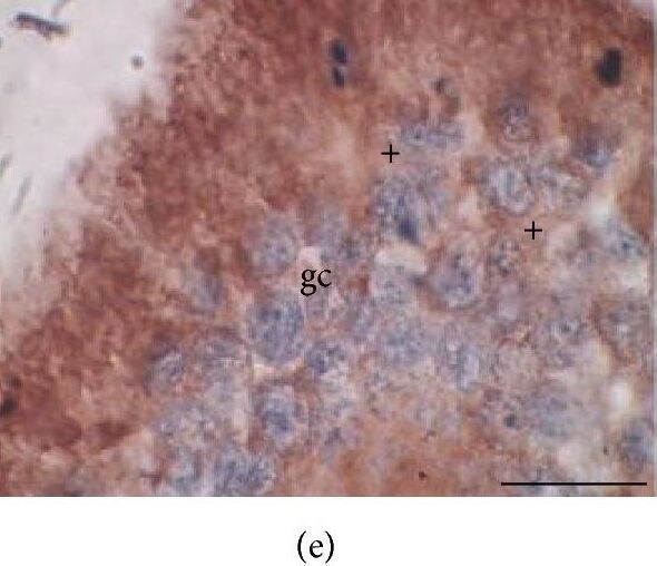 Aromatase Antibody