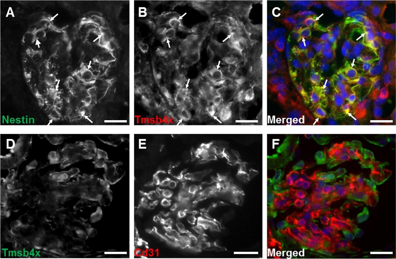 Nestin Antibody