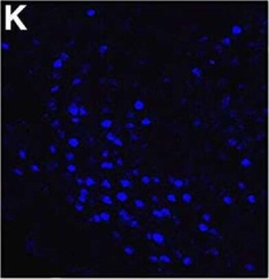 NCOA2 Antibody