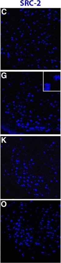 NCOA2 Antibody