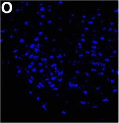 NCOA2 Antibody