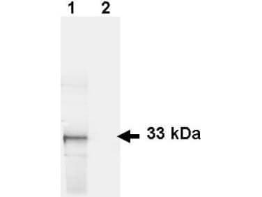 Western Blot Detection of GFP in HeLa Cells