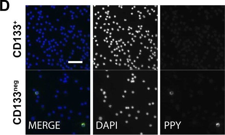 Pancreatic Polypeptide/PP Antibody