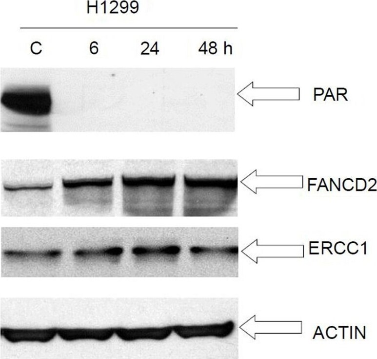 FANCD2 Antibody - BSA Free