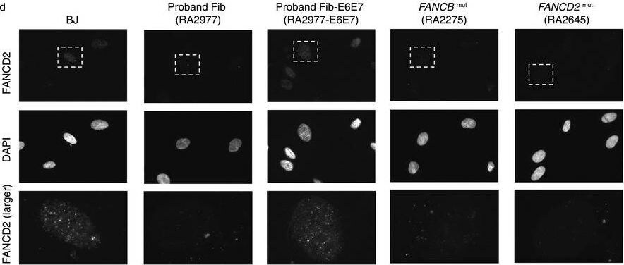 FANCD2 Antibody - BSA Free