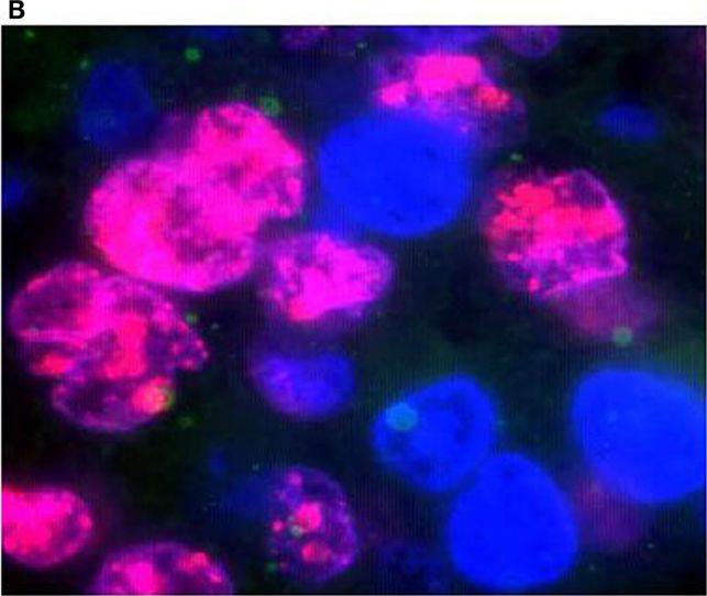 FANCD2 Antibody - BSA Free