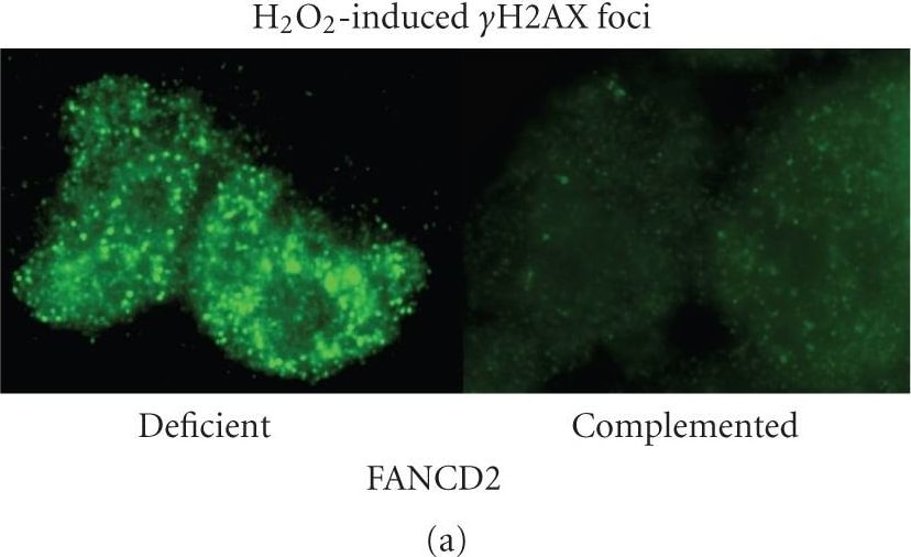 FANCD2 Antibody - BSA Free