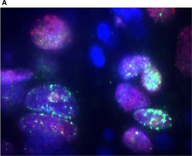 FANCD2 Antibody - BSA Free